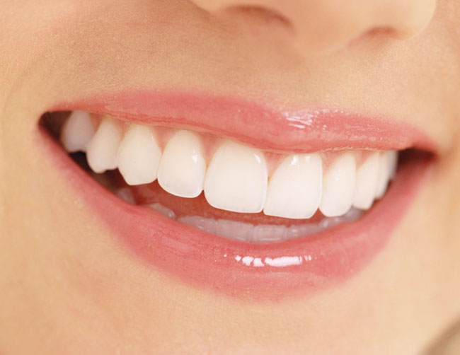 Những phương pháp tẩy trắng răng an toàn 1