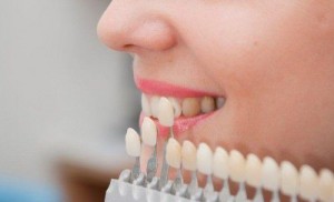 Cách làm trắng răng hiện đại và an toàn nhất 