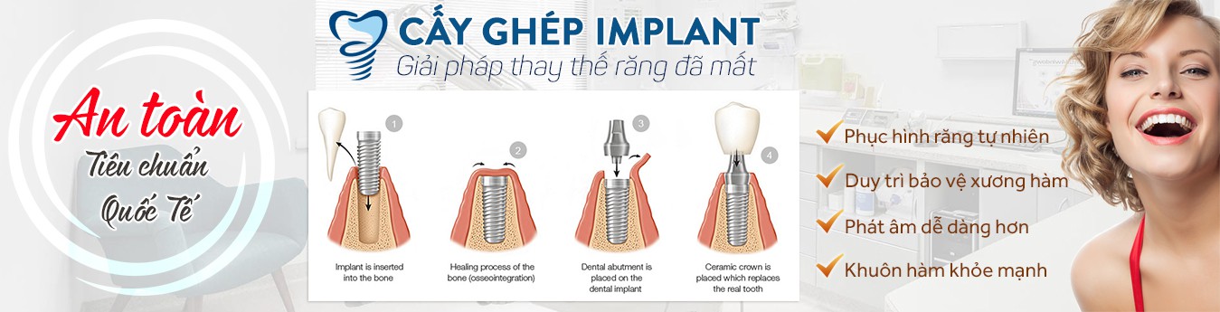 Công nghệ Implant cho người lớn tuổi slider