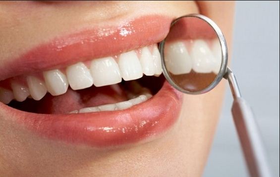 Tẩy trắng răng bằng Laser có hại không? Có biến chứng không? 2