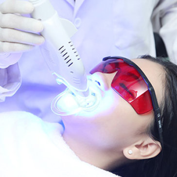 Tẩy trắng răng cho răng sâu có nên không? 2