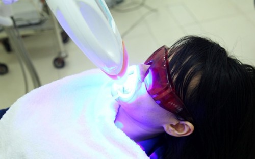 Ê buốt răng sau khi tẩy trắng do nguyên nhân gì? 2