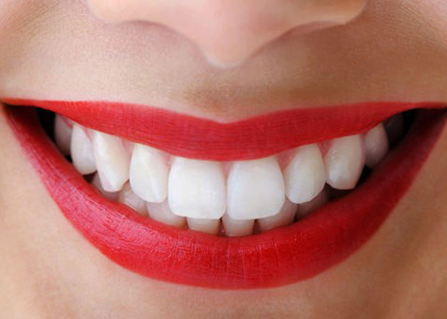 Tẩy trắng răng như thế nào là tốt nhất? 1