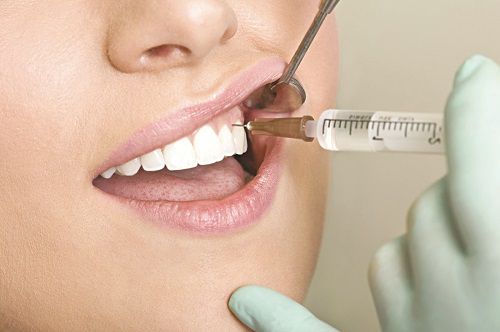 Kỹ thuật bọc răng sứ có đau không? 3