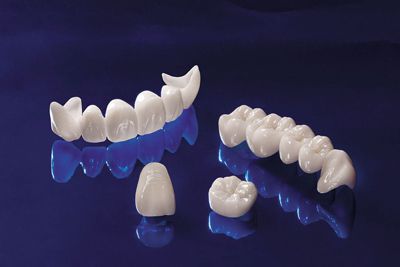 Trường hợp răng lấy tủy có nên bọc lại hay không? 3