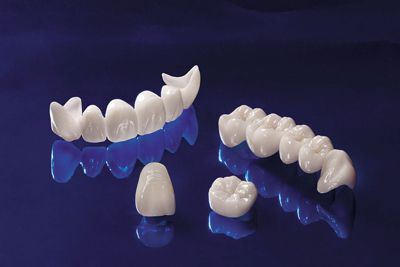 Răng sứ cao cấp là loại răng sứ nào? 1