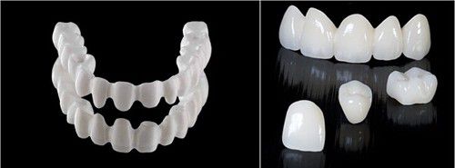 Răng sứ cercon thẩm mỹ - Giải pháp phục hình chỉnh nha hiệu quả 1