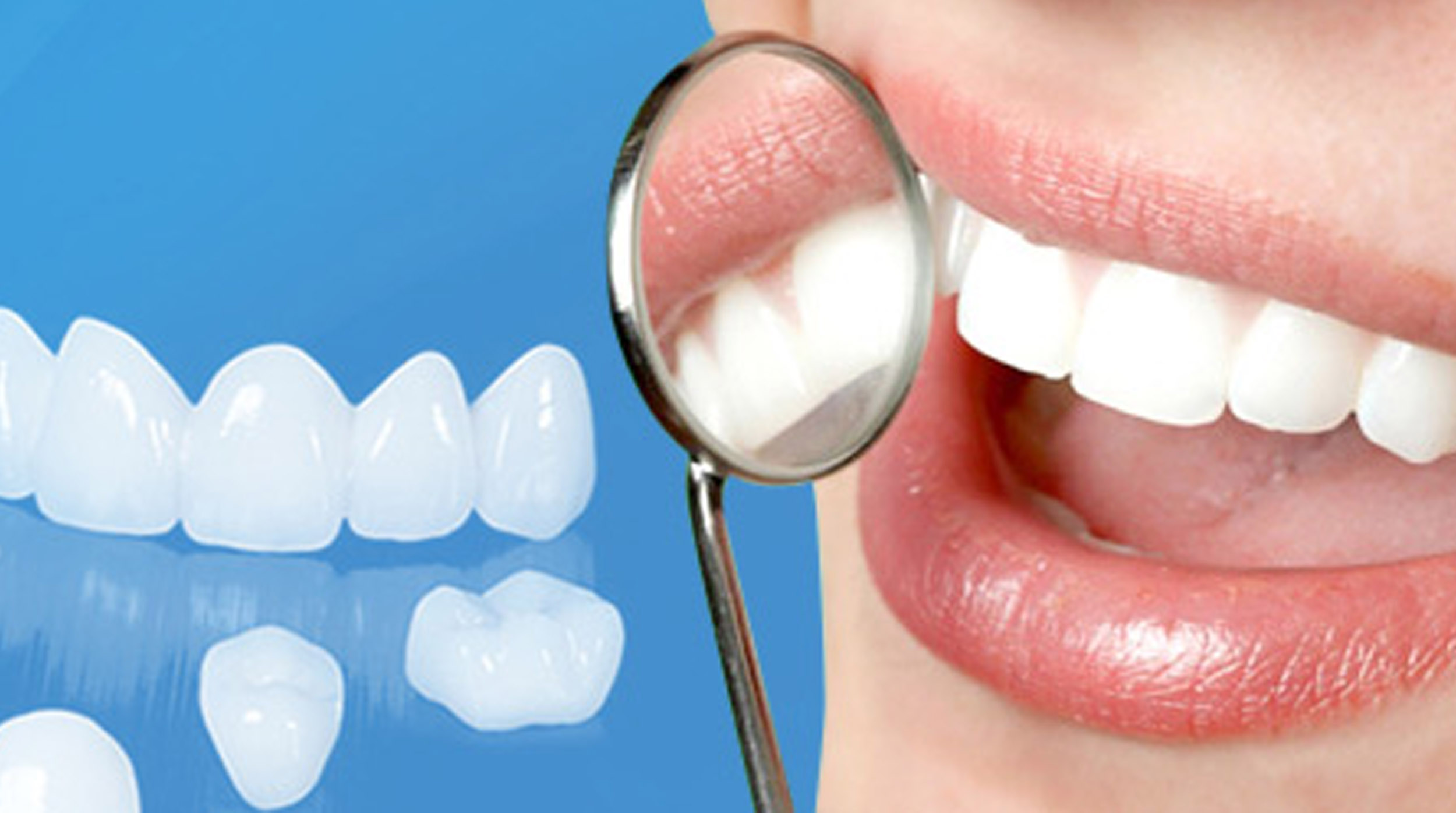 Chuyên gia Nha khoa nói gì về vấn đề răng sứ có niềng được không 2
