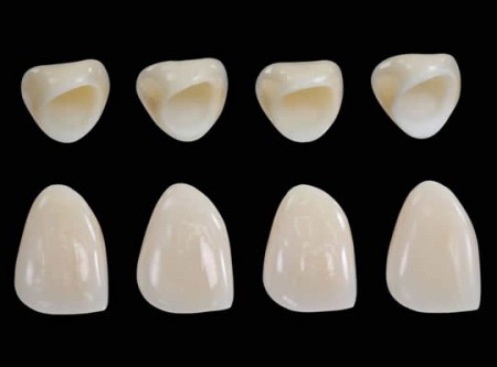 Thông tin về kỹ thuật bọc răng sứ zirconia 1