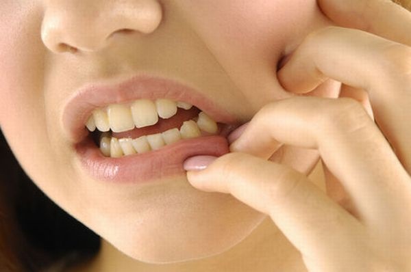 Tiến hành nhổ răng khôn có nguy hiểm không? 2
