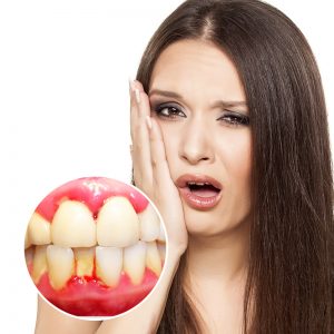Khi bị chảy máu chân răng nên uống thuốc gì? 1