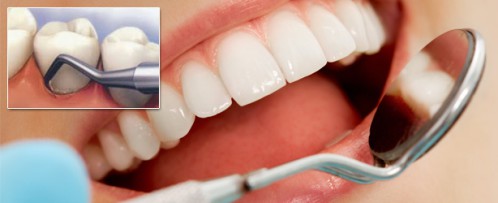 Khi bị chảy máu chân răng nên uống thuốc gì? 3