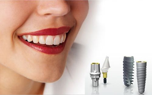 Quy trình cấy ghép răng implant như thế nào? 1