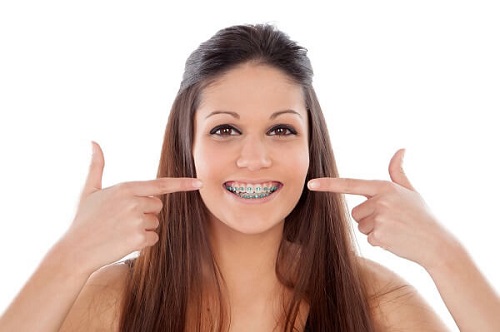Cách chỉnh răng đều không cần niềng cho bạn-2 Cách chỉnh răng đều không cần niềng cho bạn