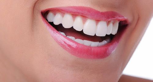 Trám răng loại nào tốt nhất hiện nay? Nhờ bác sĩ tư vấn 2