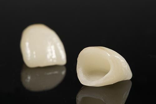 Răng sứ có mài được không? Câu trả lời chính xác-1 Răng sứ có mài được không? Câu trả lời chính xác