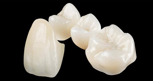 Chuyên gia tư vấn: Lắp răng sứ có tháo ra được không?