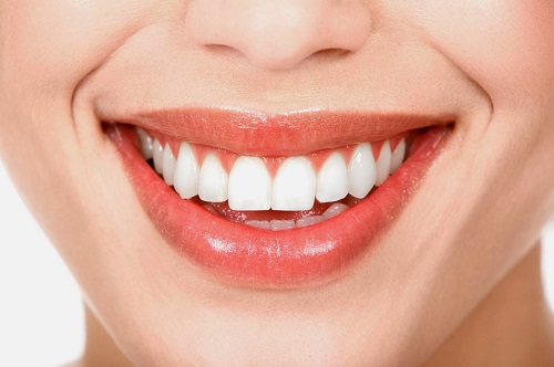 Tác hại của việc tẩy trắng răng là gì? Nha khoa chia sẻ 3