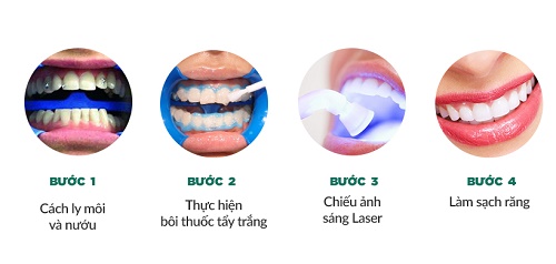 Tẩy trắng răng brite smile hiệu quả ra sao? 2