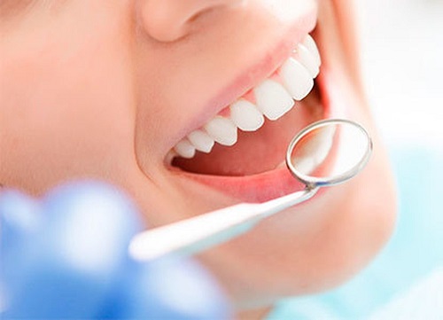 Tẩy trắng răng có ảnh hưởng gì không? Câu chuyện thực tế 3