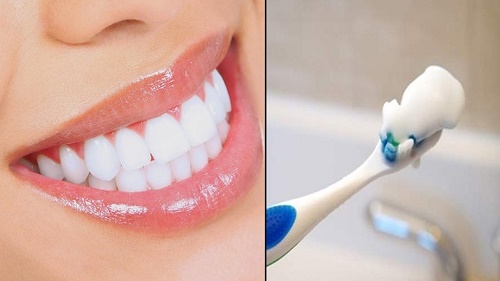 Có nên tẩy trắng răng nhiều lần không? Vì sao? 3