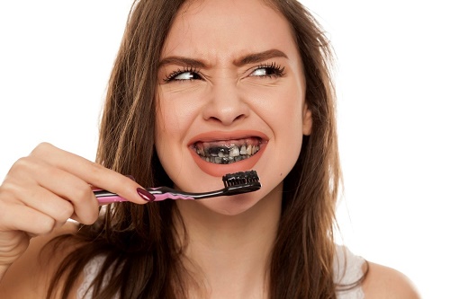 Tẩy trắng răng bằng than hoạt tính hiệu quả cao không? 2