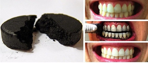 Tẩy trắng răng bằng than hoạt tính hiệu quả cao không? 3