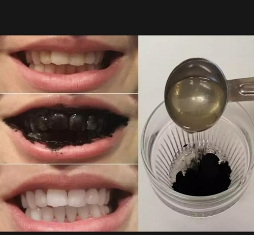 Tẩy trắng răng bằng than củi - Mẹo vặt tẩy trắng răng 1 Tẩy trắng răng bằng than củi - Mẹo vặt tẩy trắng răng 1