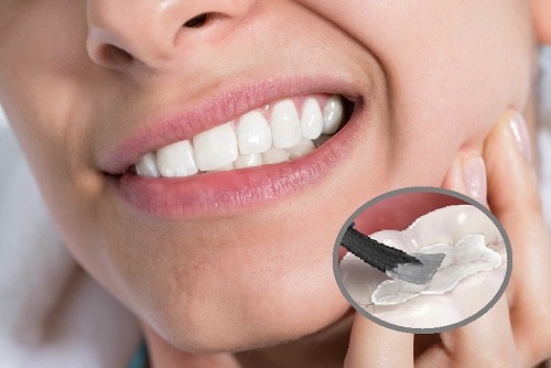 Trám răng bao lâu thì ăn được? Các lưu ý sau khi trám răng 1
