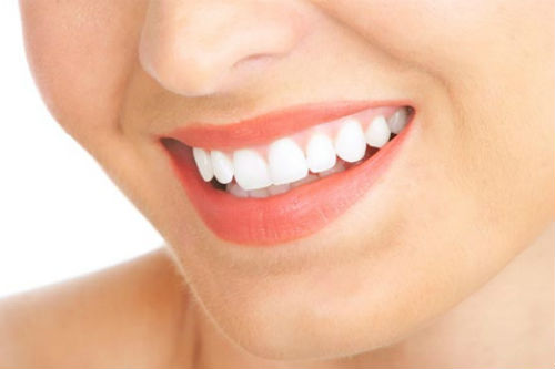 Niềng răng xong có nên tẩy trắng răng không? Lời khuyên từ nha khoa 3