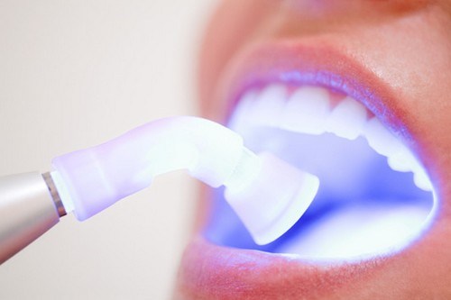 Bột tẩy trắng răng eucryl có tốt không? Tìm hiểu chuyên sâu 3