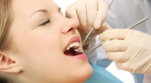 Trám răng có đau không? Các lưu ý khi trám răng 2
