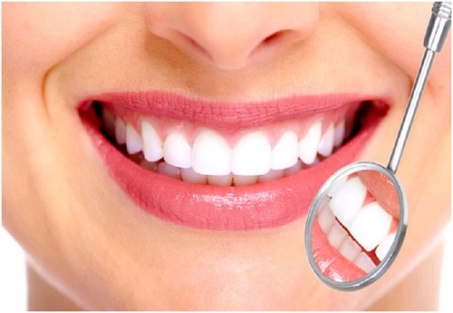 Bọc răng sứ có bền không? Hiệu quả ra sao? 1