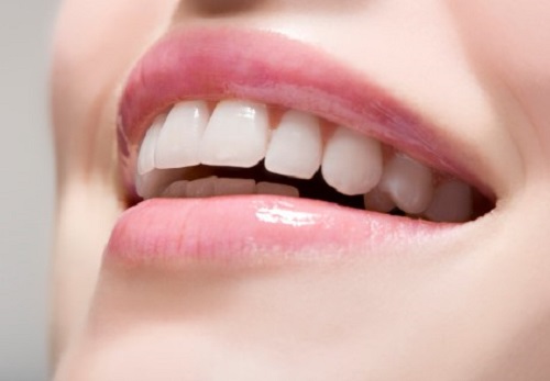 Bọc răng sứ cercon có đắt không? Tìm hiểu chi phí tại đây 2