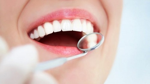 Bọc răng sứ bị hôi miệng - Nguyên nhân chính 3